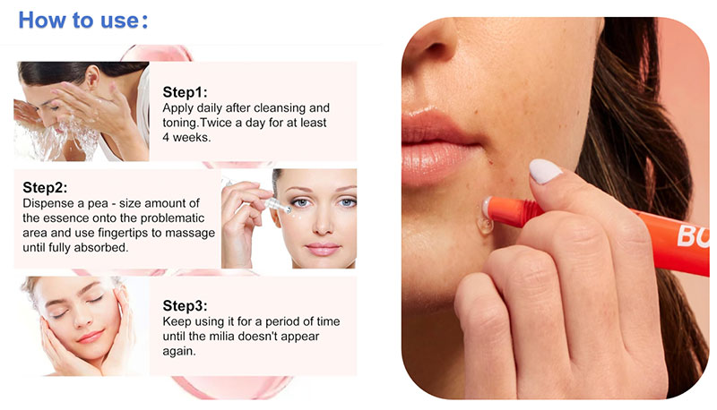 acne spot serum